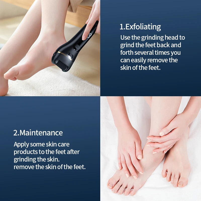 Electric Foot Grinder Callus Remover
